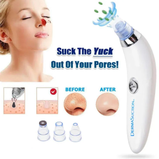 5 in 1 Electric Blackhead Acne Oil Remover Vacuum Suction Face Pore Cleaner Facial Beauty Equipment, Blackhead Removal Machine